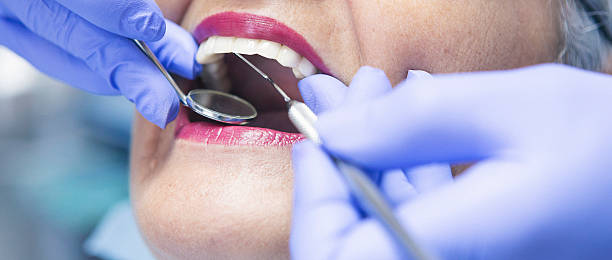 Best Emergency Wisdom Teeth Removal in Charlack, MO